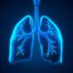Home Health Care Northridge CA - Symptoms of Pulmonary Embolism