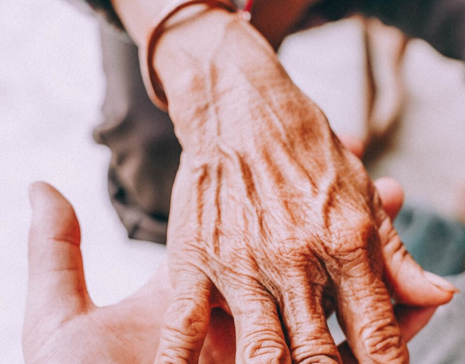 Photos of arthritis in an elderly woman’s hand.
